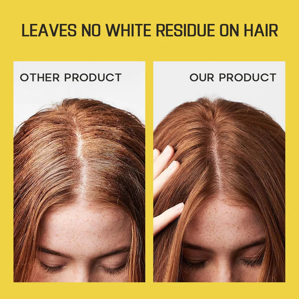 Dry Hair Shampoo Spray Instantly Fresh Volumizing Hair Dry Shampoo