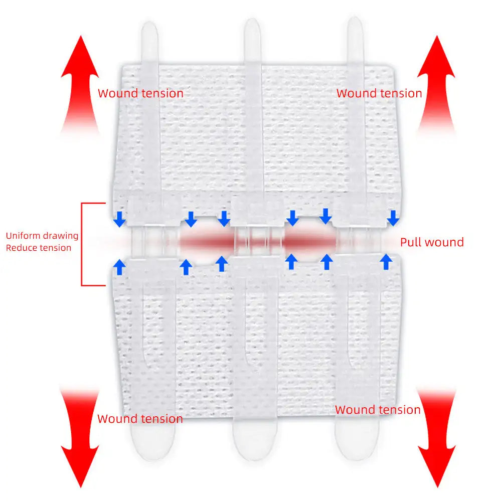 Emergency Laceration Closures Band Zipper Painless