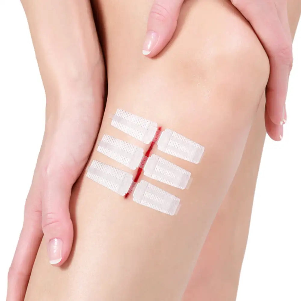 Emergency Laceration Closures Band Zipper Painless