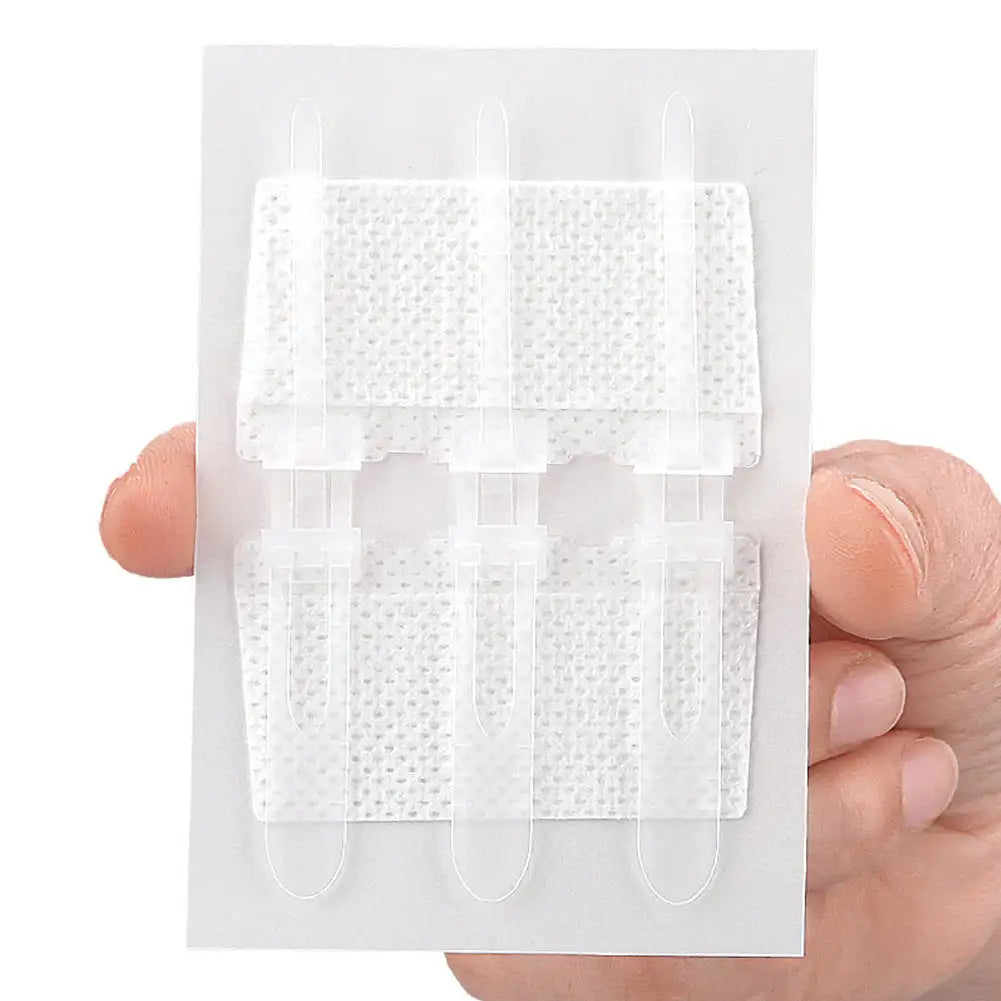 Emergency Laceration Closures Band Zipper Painless