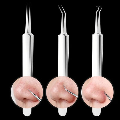 PROFESSIONAL FACIAL BLACKHEAD REMOVER TWEEZER