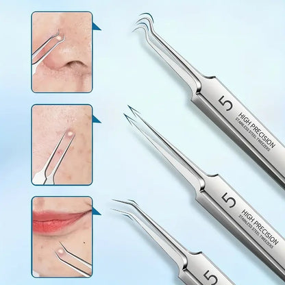 PROFESSIONAL FACIAL BLACKHEAD REMOVER TWEEZER