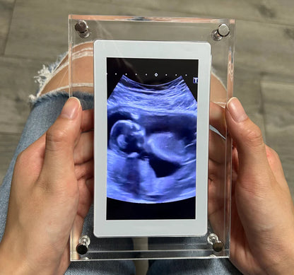 Motion Video frame