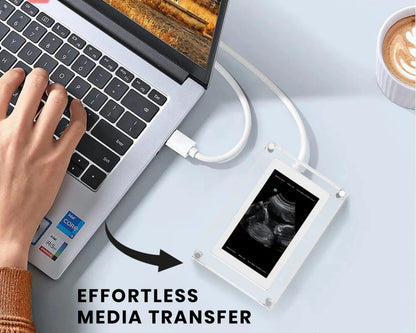 Motion Video frame