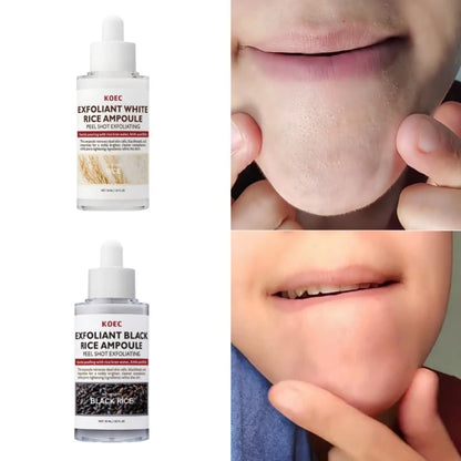 Instant Peel Shot Glow