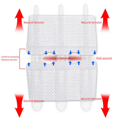 Emergency Laceration Closures Band Zipper Painless