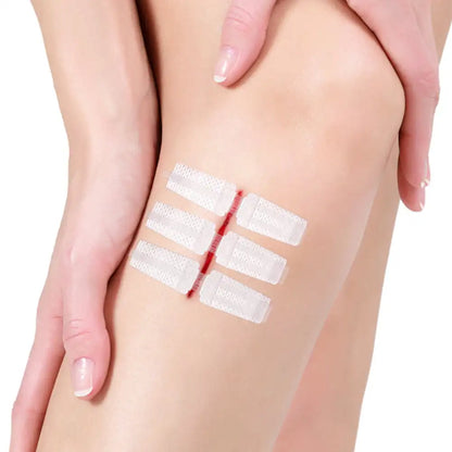 Emergency Laceration Closures Band Zipper Painless