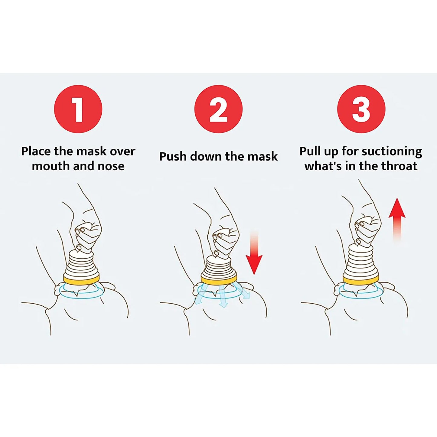 CHOKING EMERGENCY DEVICE