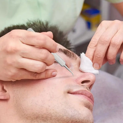PROFESSIONAL FACIAL BLACKHEAD REMOVER TWEEZER